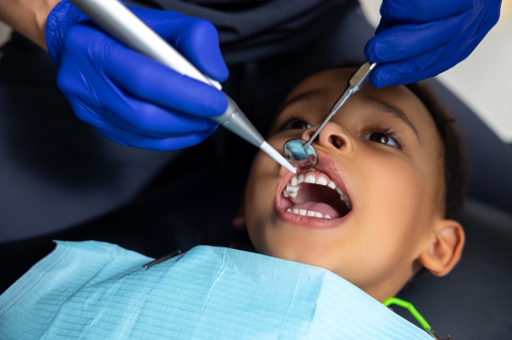 Everything You Need to Know About Pediatric Dental Restorations