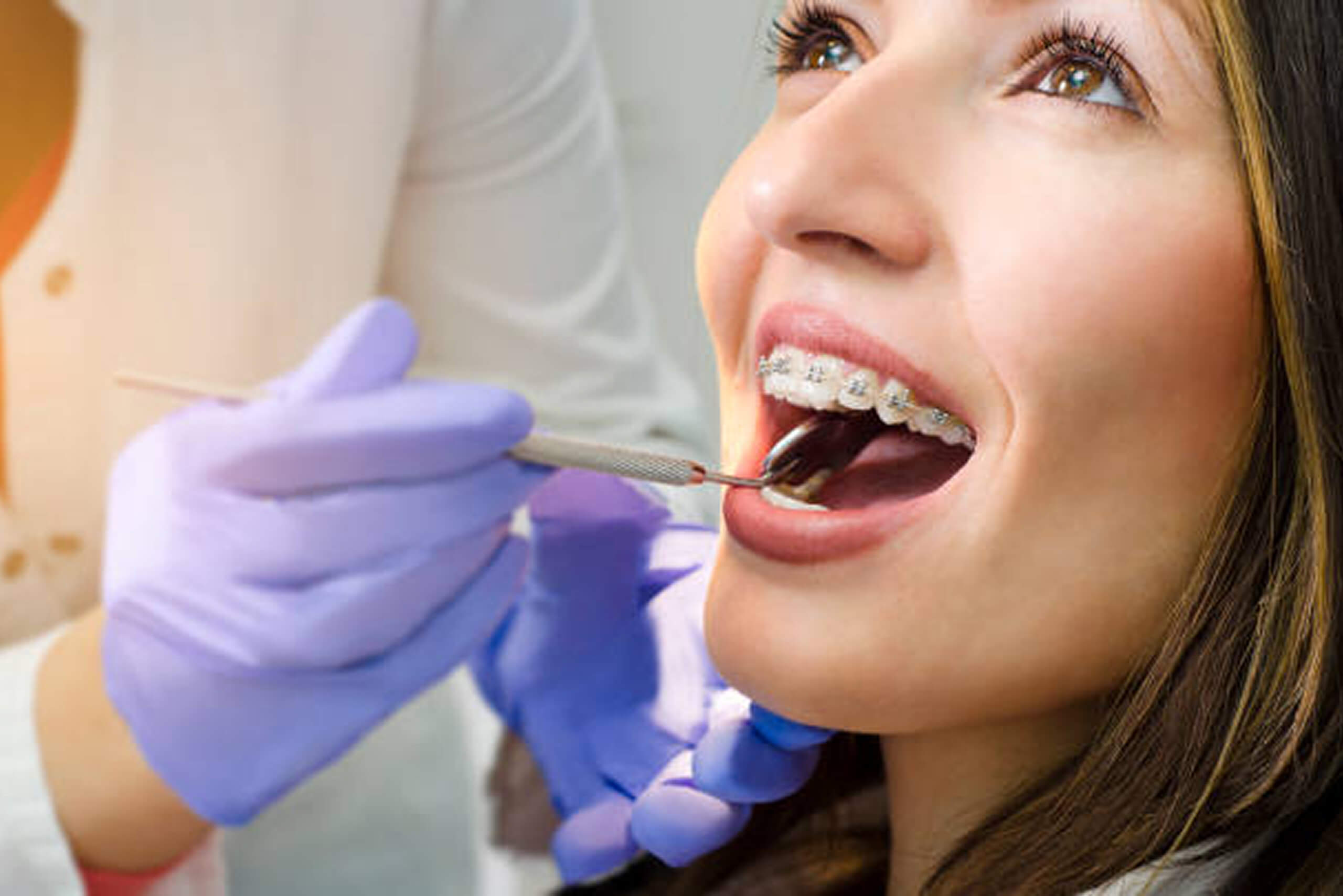 braces for adults