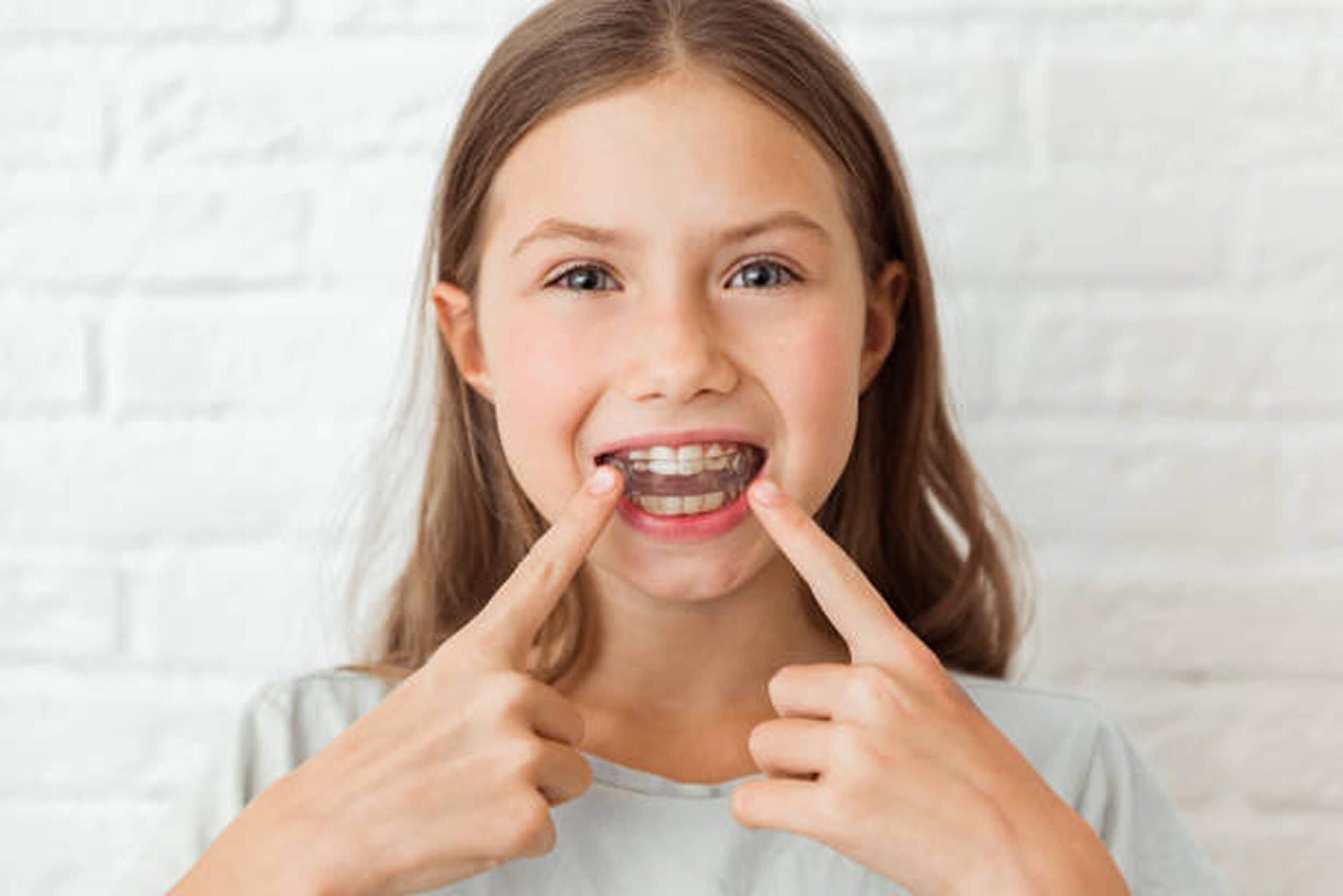 invisalign for kids